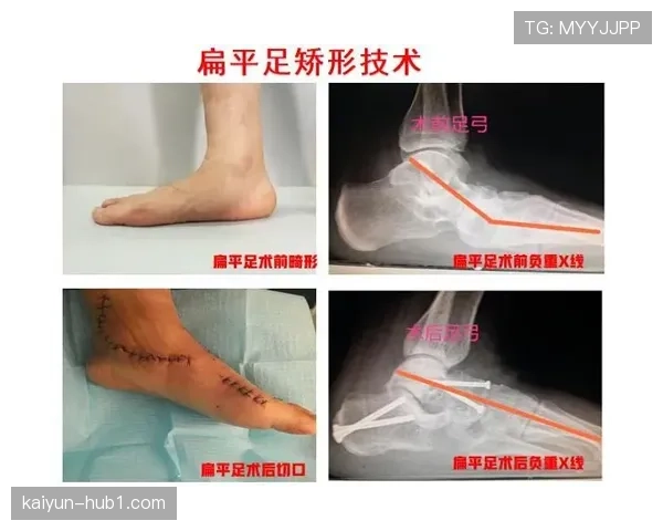 徐杰脚踝韧带状况引担忧 医学专家提示习惯性崴脚隐患